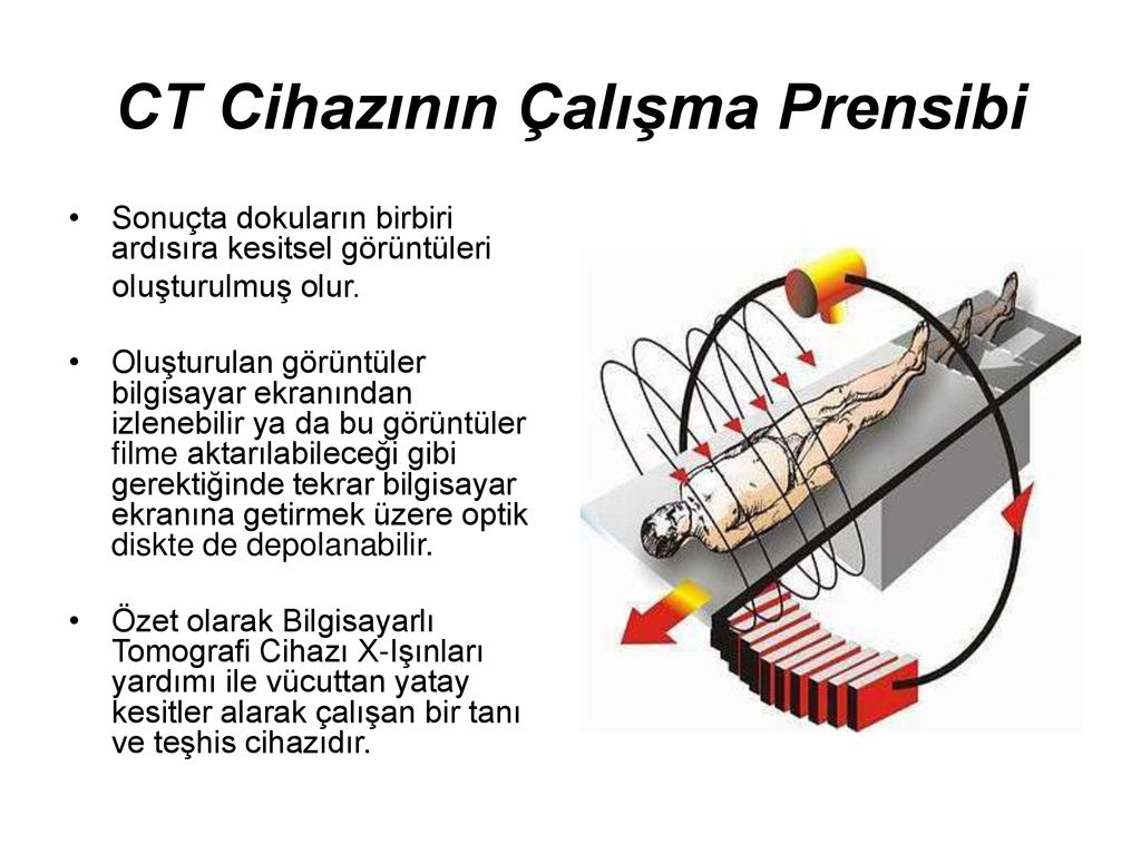 Bilgisayarl Tomografi Cihaz Ct Ppt Indir